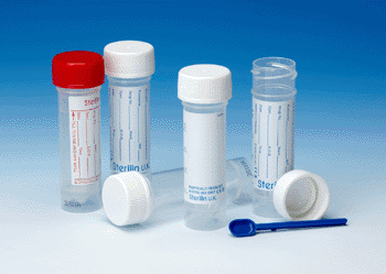 Image: New Thermo Scientific Sterilin Quick Start 30-mL polypropylene universal containers (Photo courtesy of Thermo Scientific). 